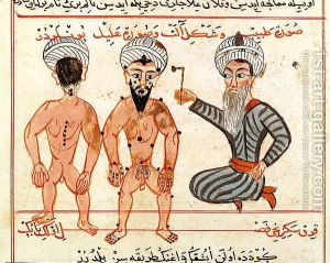 Charaf-ed-Din Cauterisation of leprosy lesions, 1466